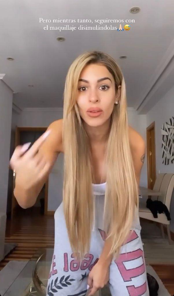 “Estoy sin filtro”: Oriana Marzoli enseña sus ojeras