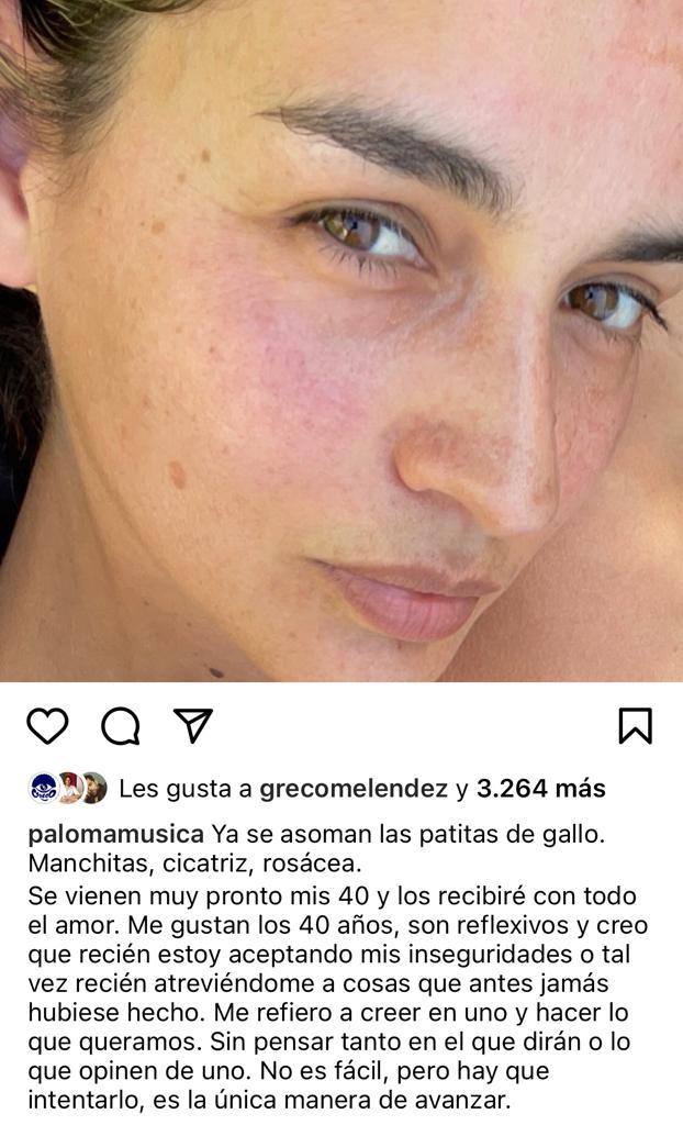 “Patitas de gallo”: Paloma Soto arrasa con foto sin maquillaje