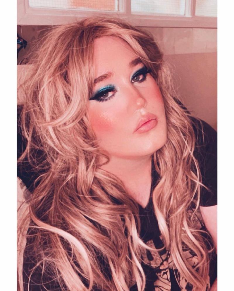 Comparan a Nicolás Yunge con Adele por nuevas fotos