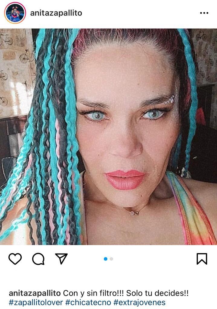 “Tú decides”: Zapallito Italiano encanta al mostrarse sin filtro