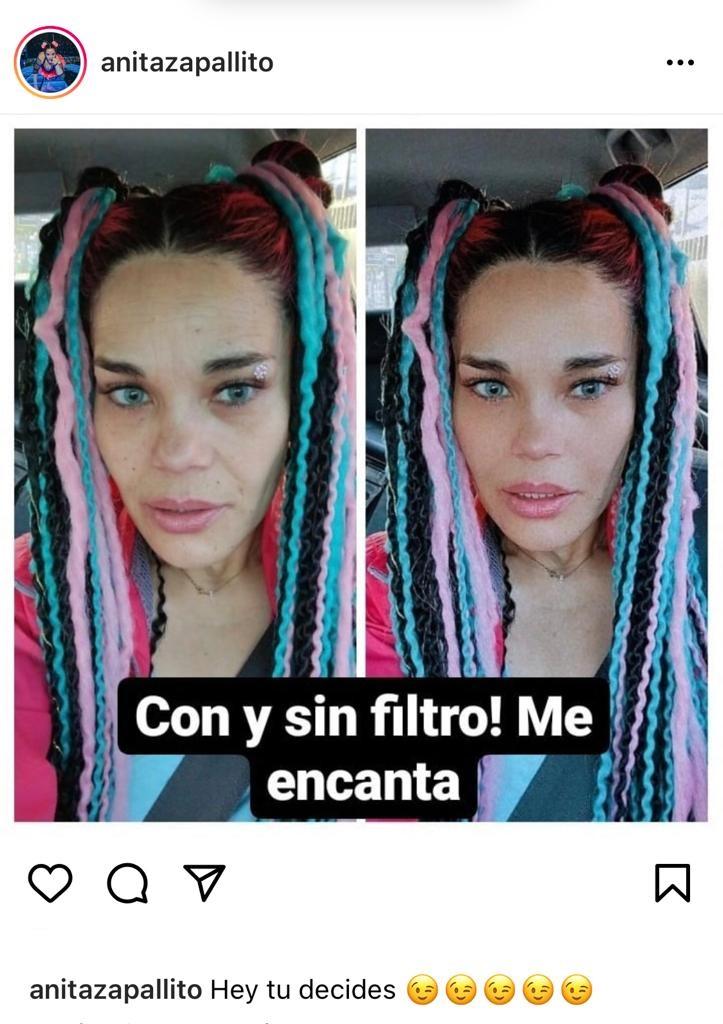 “Tú decides”: Zapallito Italiano encanta al mostrarse sin filtro