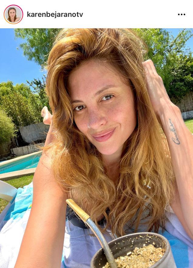 Karen Bejarano muestra sus pecas sin filtro