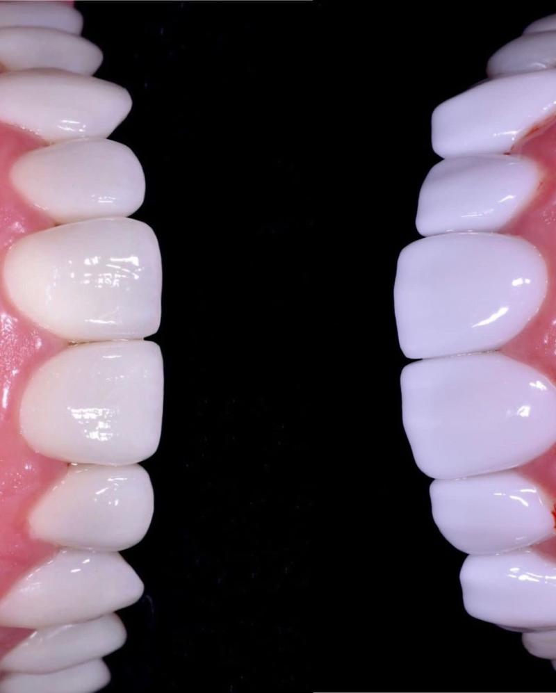 Fran Undurraga muestra el antes y después de sus dientes