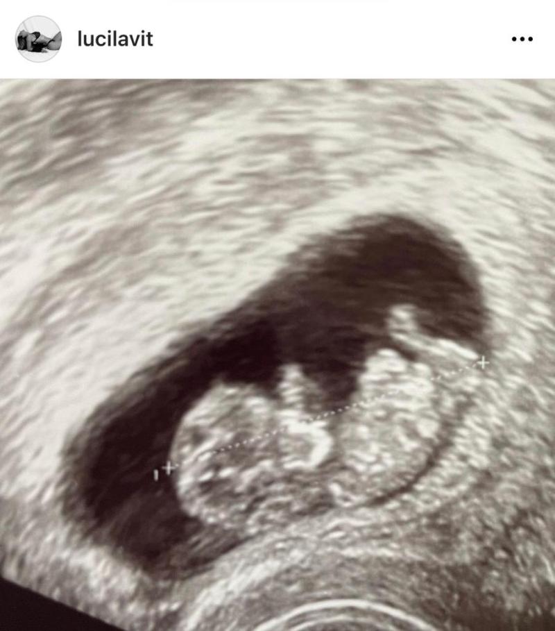 Hija de Rafael Olarra deslumbra en fiesta de graduación