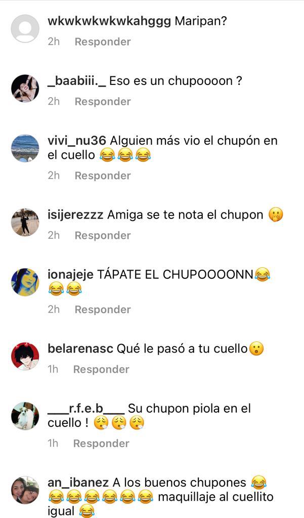 “¿Eso es un chupón?”: Aylén Milla genera burlas por fotos