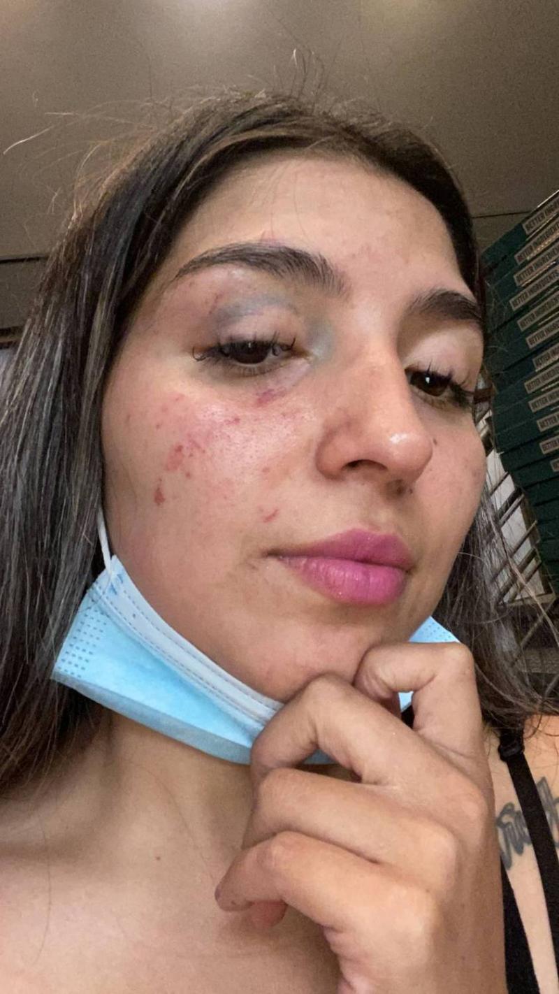 Mujer agredida por Naya Fácil pide 8 años de cárcel para la influencer