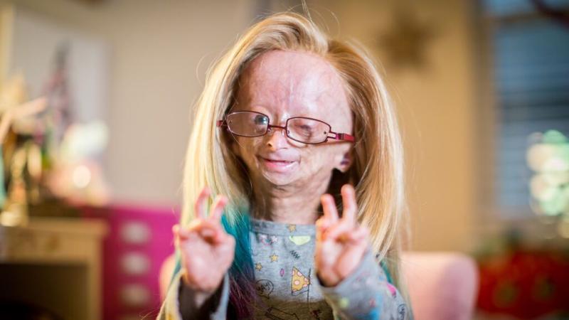 Adalia Rose Williams