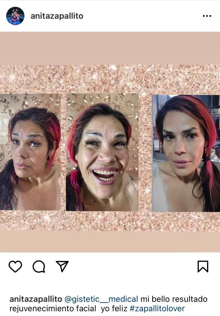 “De 15”: Zapallito Italiano impacta al enseñar su cambio facial