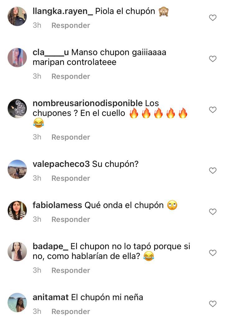 “¿Eso es un chupón?”: Aylén Milla genera burlas por fotos