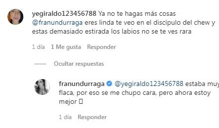 Fran Undurraga es criticada por nuevo retoque estético: "Muy plástica"