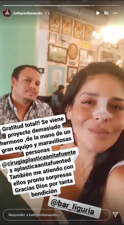 Kathy Orellana sorprende con nuevo retoque facial