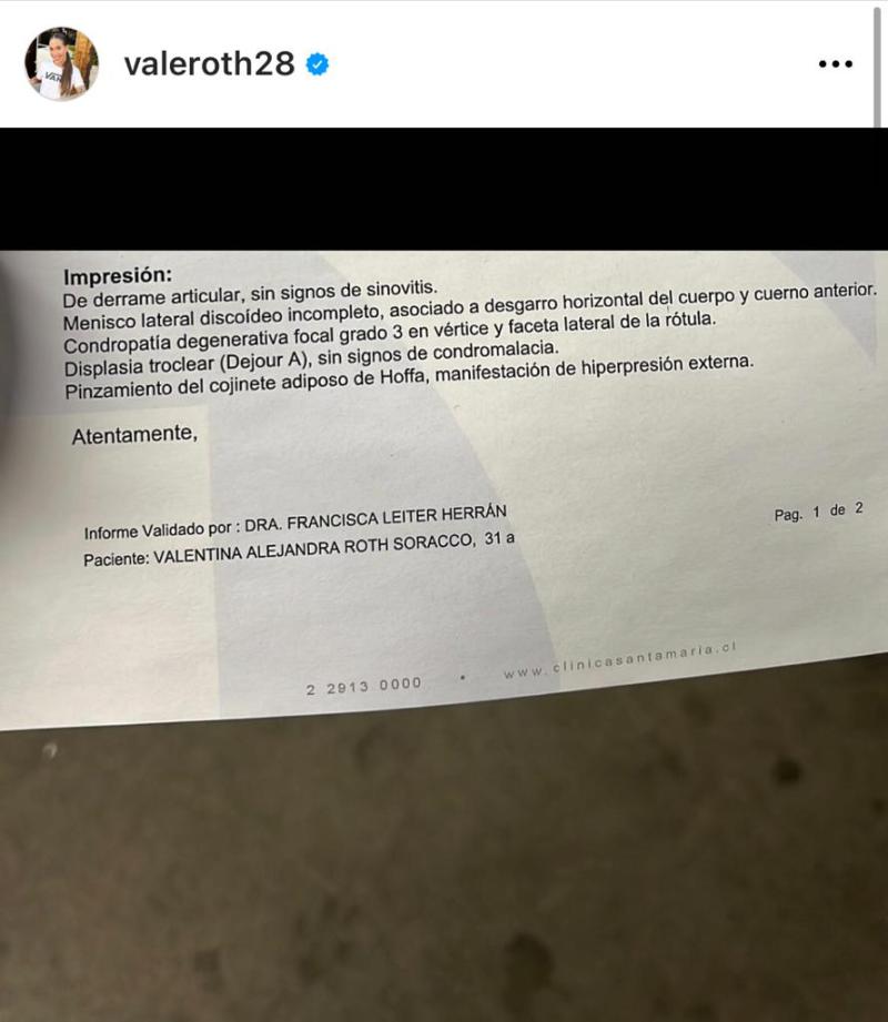 Vale Roth revela su cambio físico tras dejar el alcohol