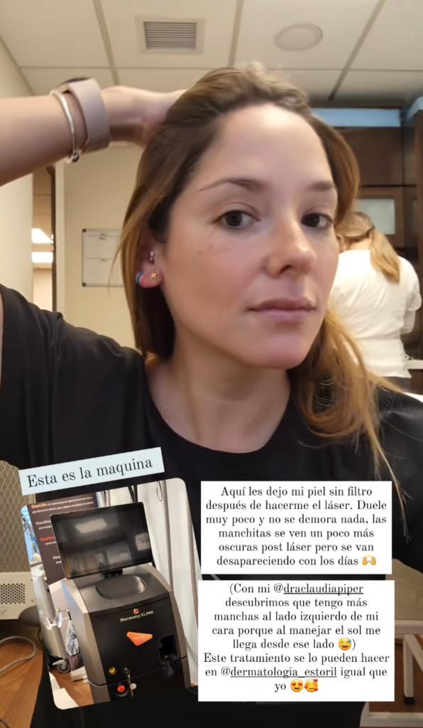 Kel Calderón se muestra sin filtro por procedimiento estético