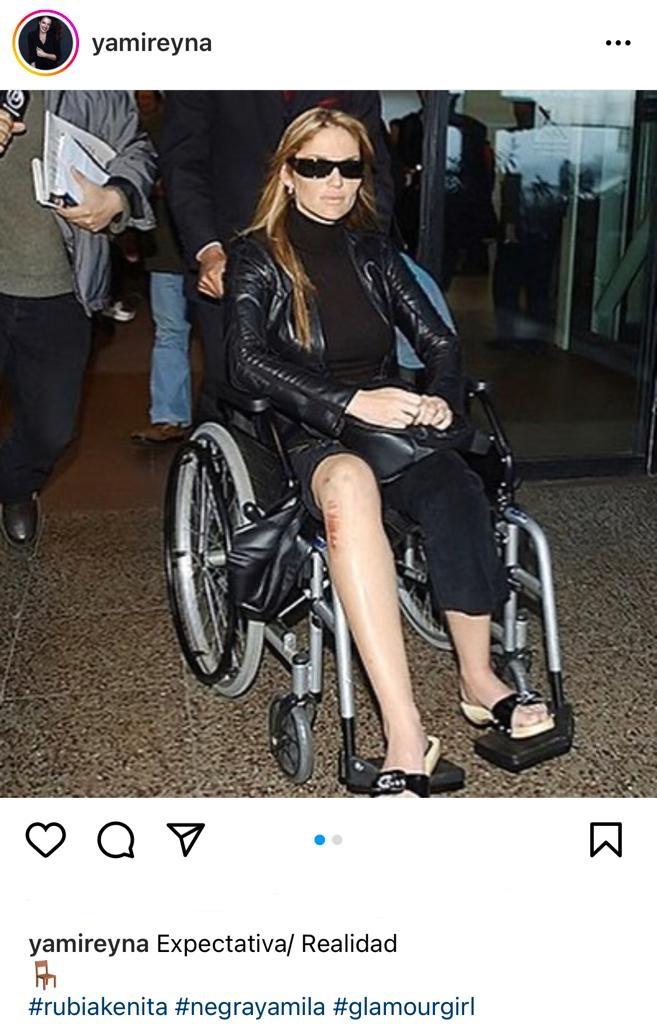 Yamila Reyna se compara con Kenita Larraín tras operación