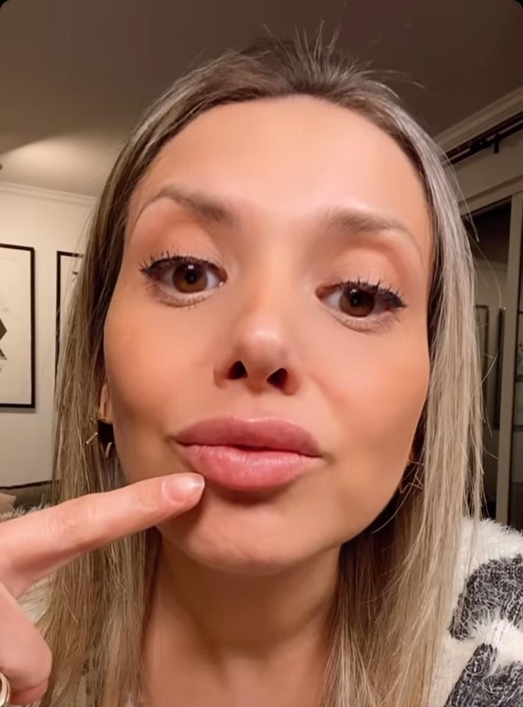 El nuevo rostro de Nicole Pérez: Se intervino sus dientes y labios