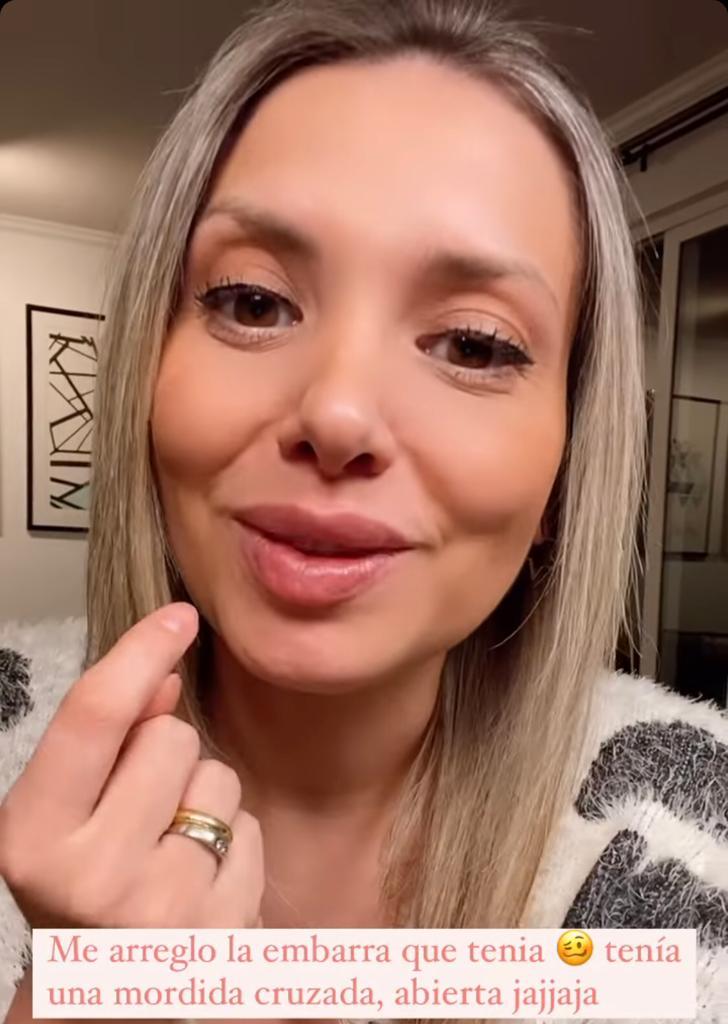 El nuevo rostro de Nicole Pérez: Se intervino sus dientes y labios