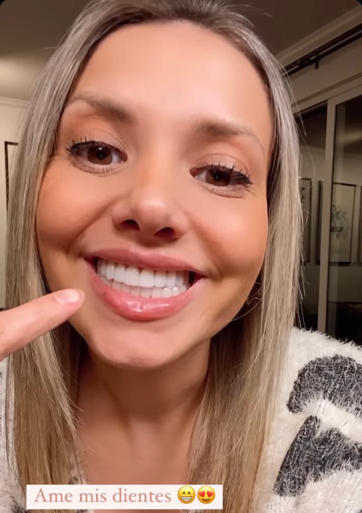El nuevo rostro de Nicole Pérez: Se intervino sus dientes y labios