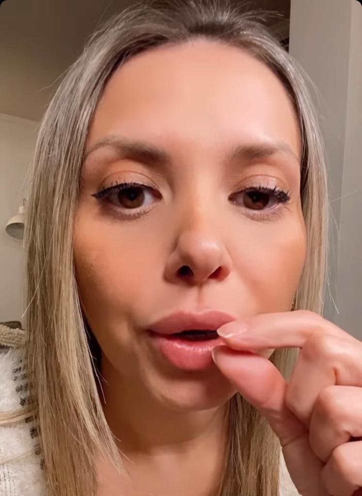 El nuevo rostro de Nicole Pérez: Se intervino sus dientes y labios