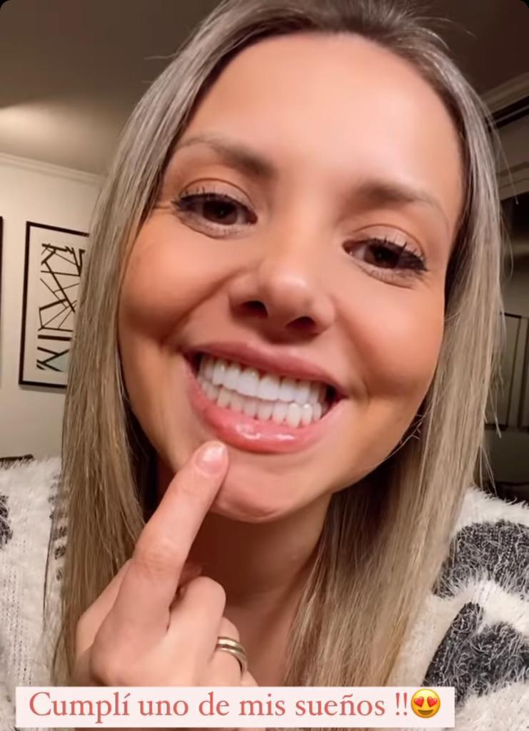 El nuevo rostro de Nicole Pérez: Se intervino sus dientes y labios