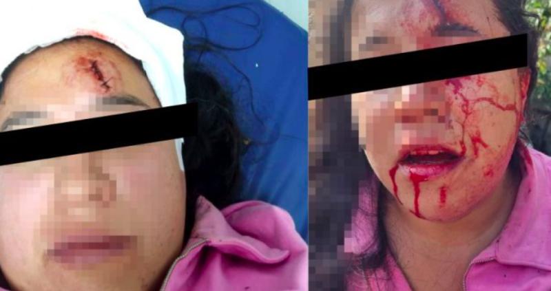 brutal agresión a pareja lésbica