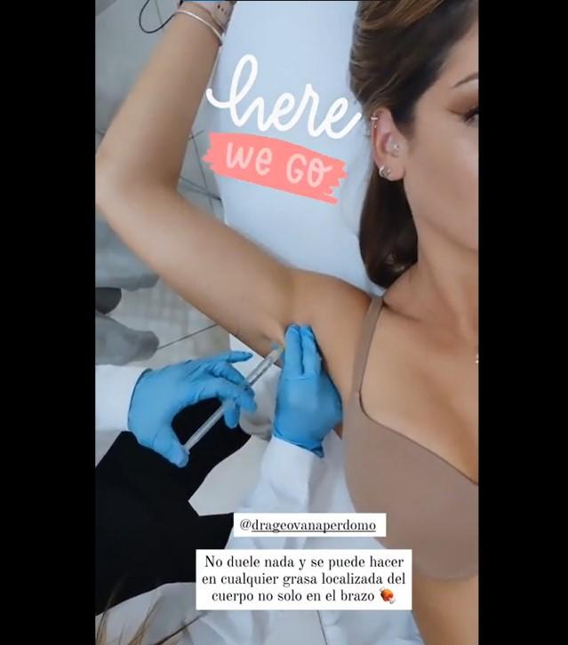 Kel Calderón se muestra sin filtro por procedimiento estético