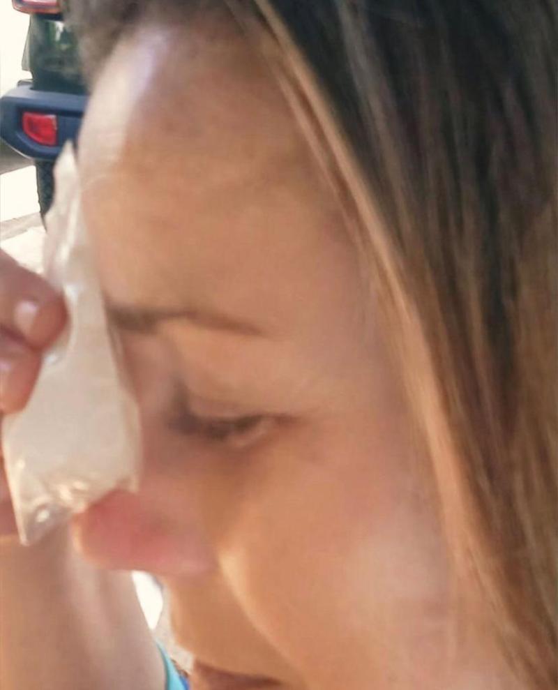 Claudia Conserva muestra cómo quedó tras insólito accidente