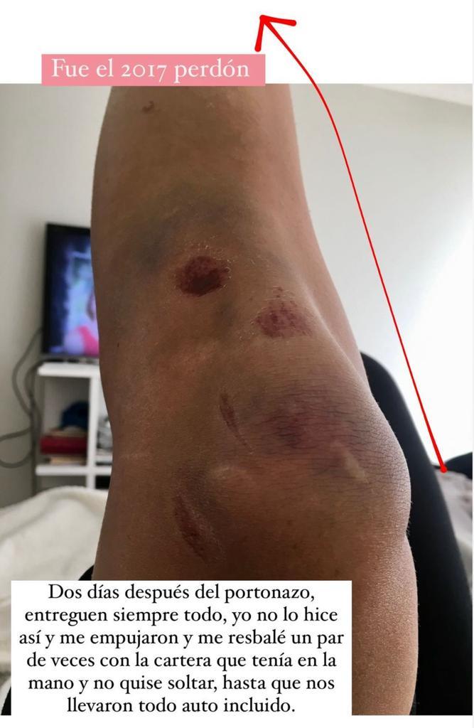 Gianella Marengo fue víctima de portonazo en el 2017