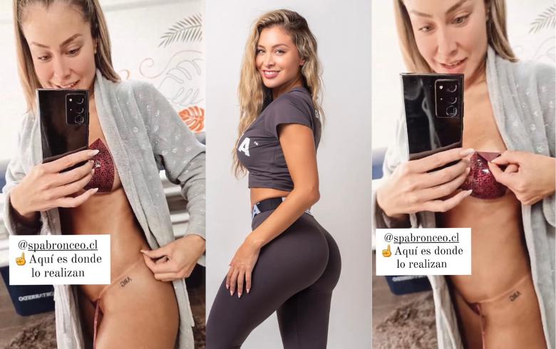 Sabrina Sosa y su último procedimiento estético