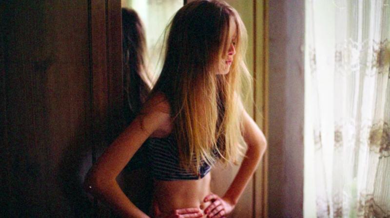 Trastornos alimentarios en Chile