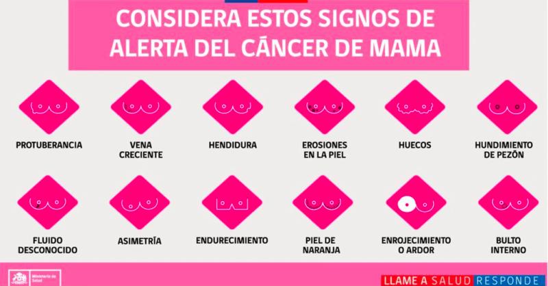 ¿Cómo detectar el cáncer de mama? La enfermedad que sufre Claudia Conserva