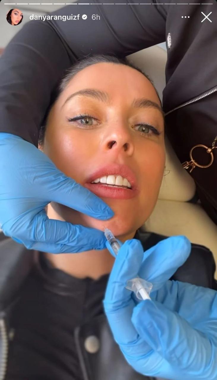 Daniela Aránguiz se sometió a nuevo procedimiento estético en su rostro