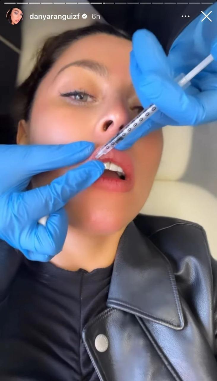 Daniela Aránguiz se sometió a nuevo procedimiento estético en su rostro