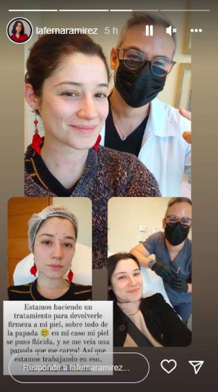 "Estamos trabajando en eso": Fernanda Salazar reveló intervención estética para mejorar su rostro