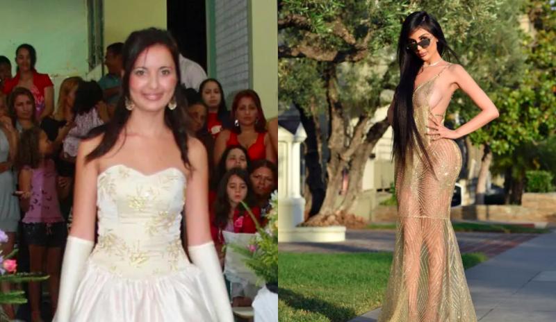 Mujer que gastó $600 millones para ser como Kim Kardashian revierte cirugías