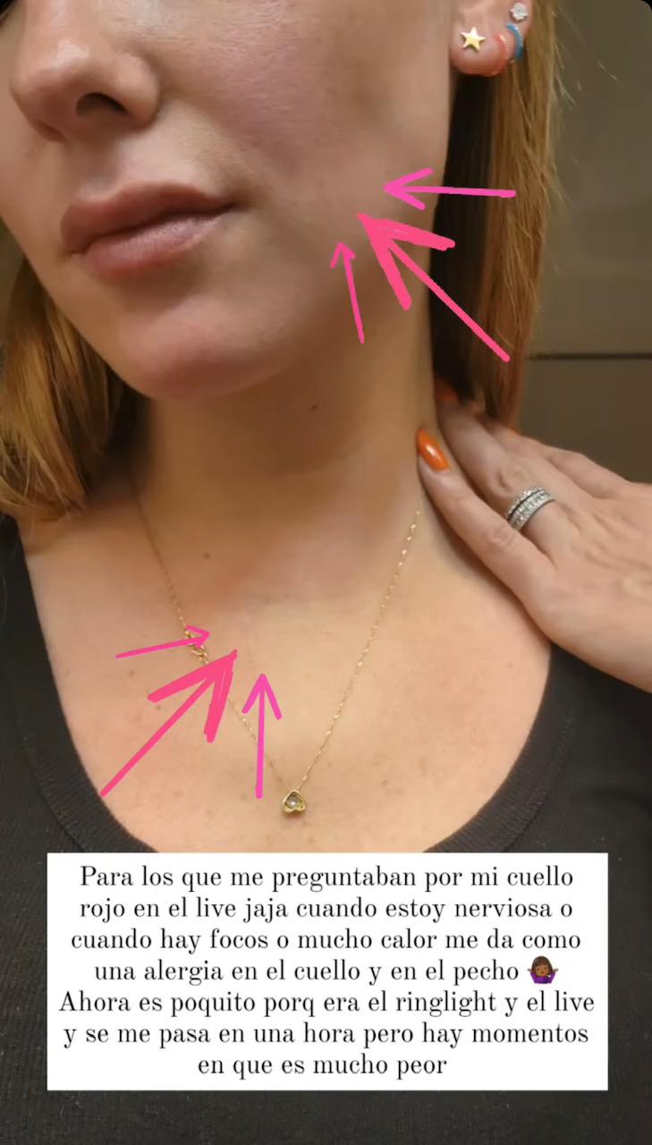 La explicación de Kel Calderón