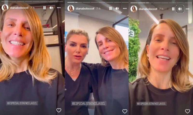 "Me dejaste preciosa": Diana Bolocco muestra los resultados del procedimiento estético que se realizó