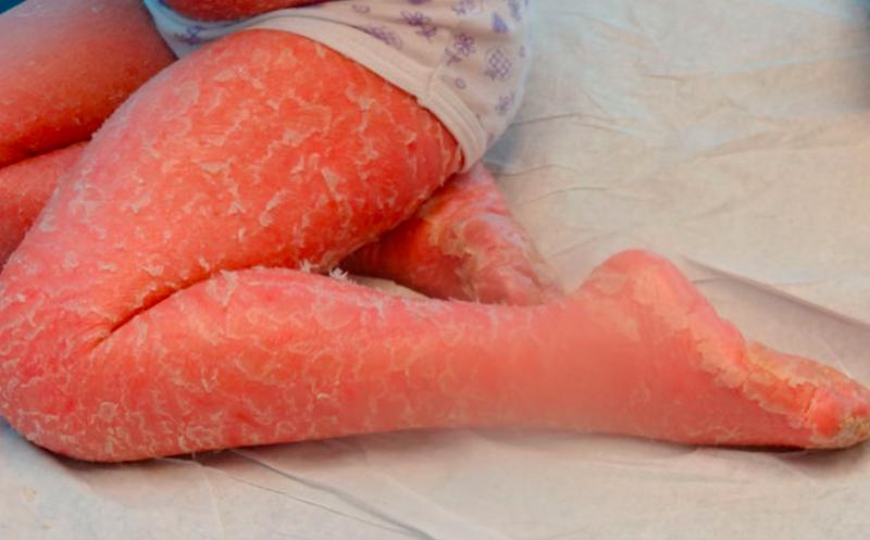 Muere bebé a dos horas de nacer: sus padres eran hermanos