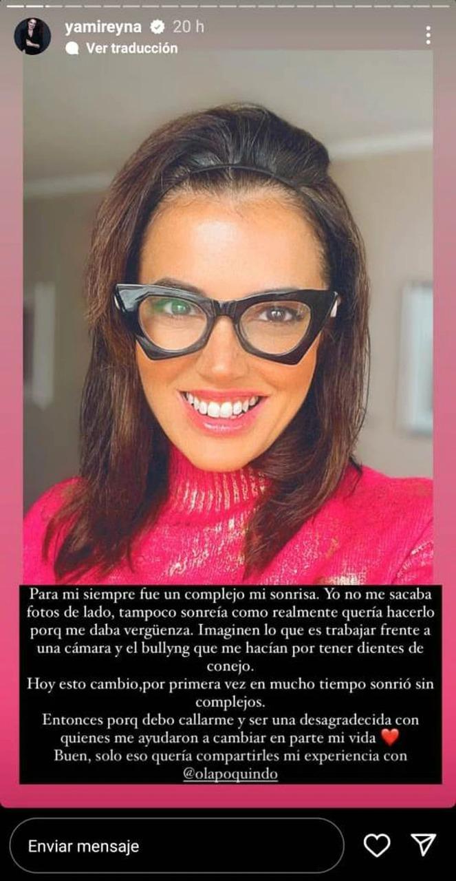 Yamila Reyna encanta al mostrar su nueva sonrisa