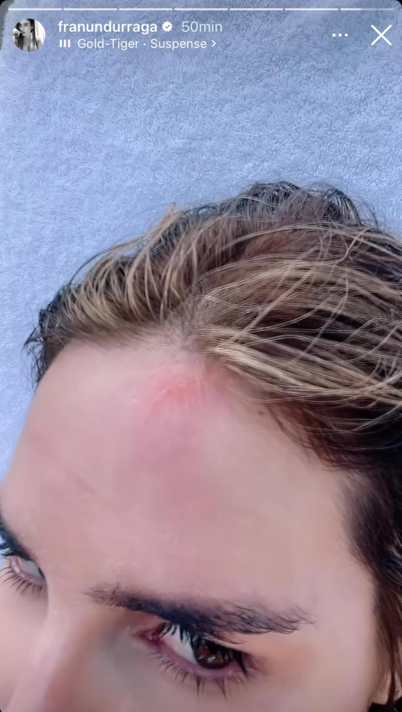 Fran Undurraga - Instagram