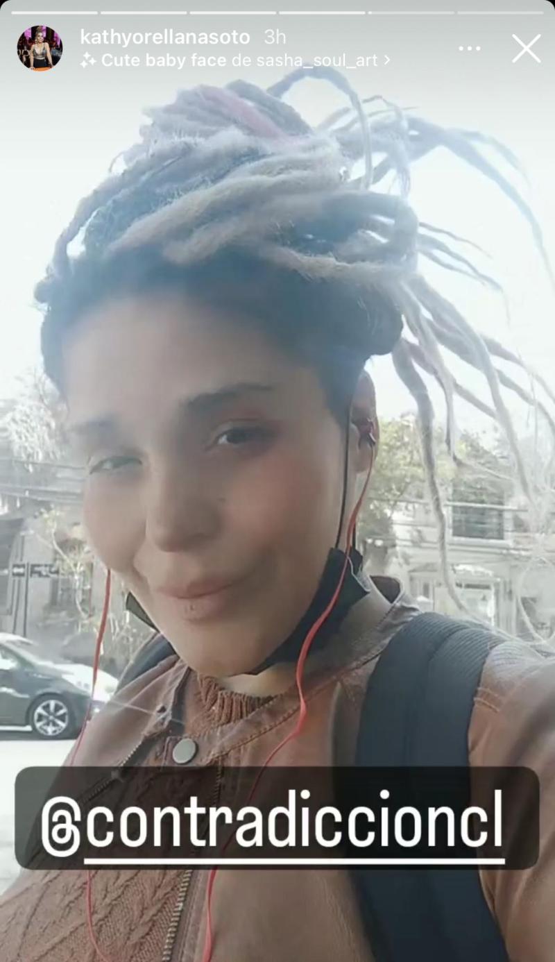 Kathy Orellana revela detalles de su tratamiento