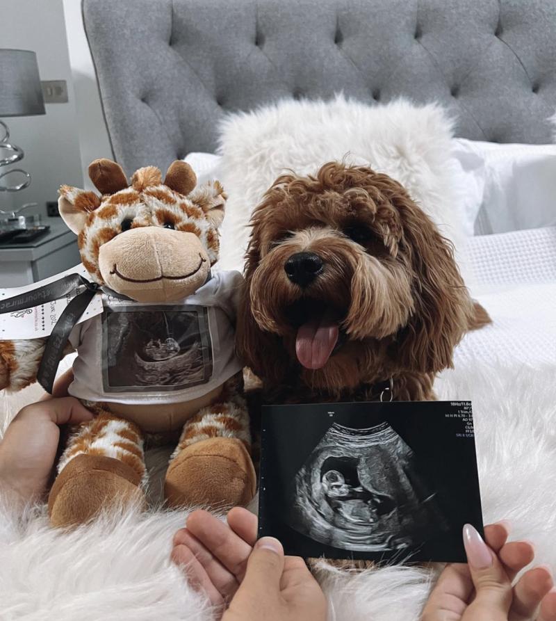 Ben Brereton y Kimberley Abbott anuncian que serán padres