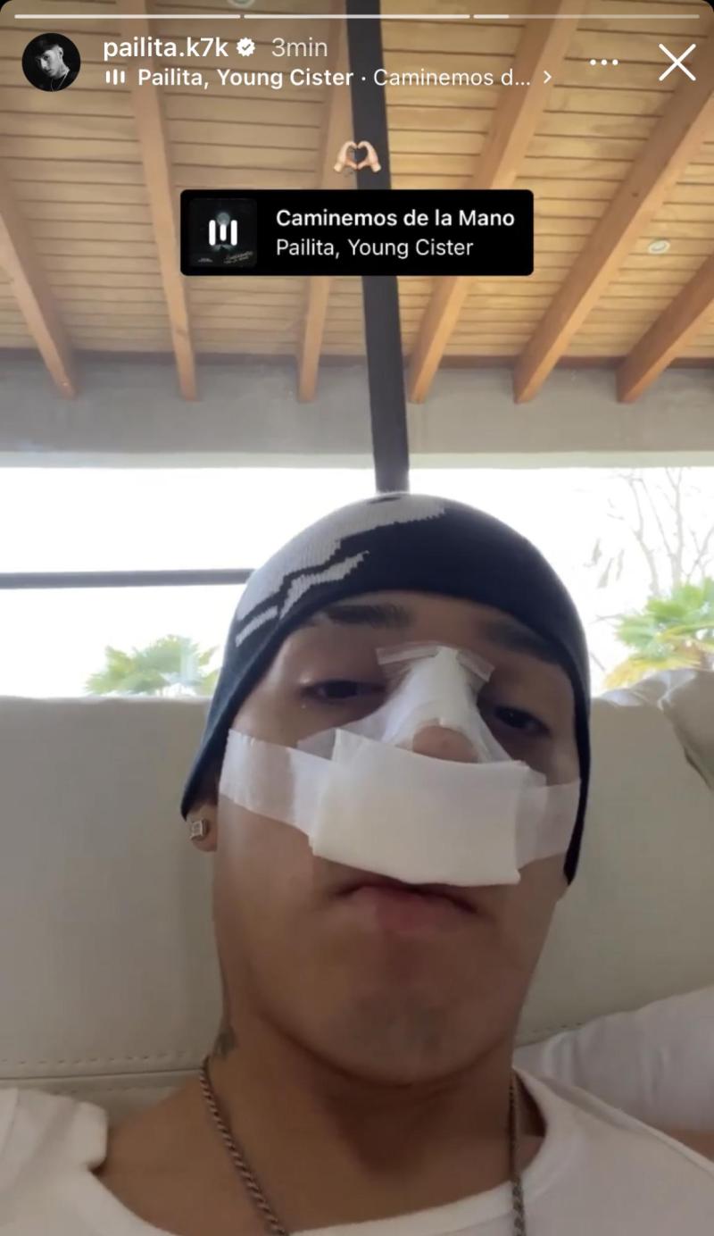 Pailita recuperándose