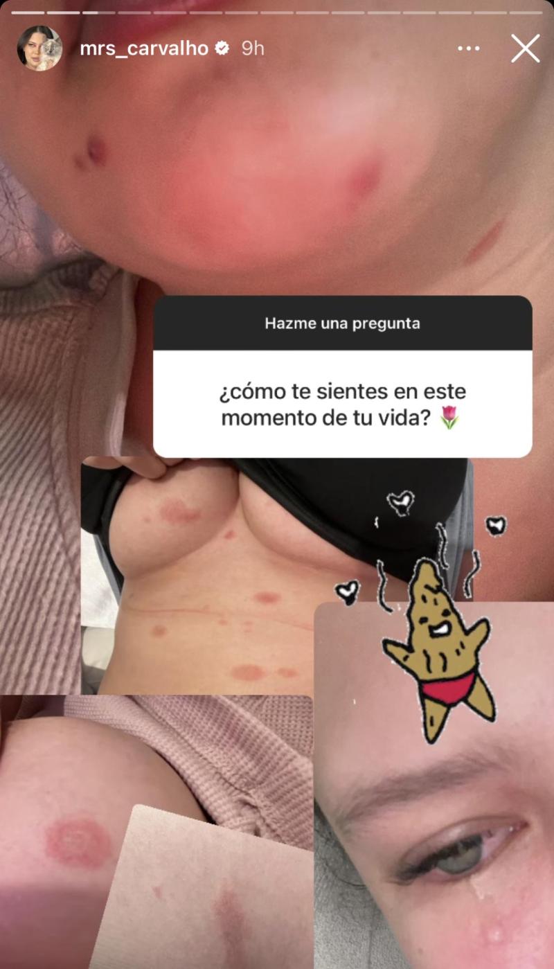 Michelle Carvalho - Instagram