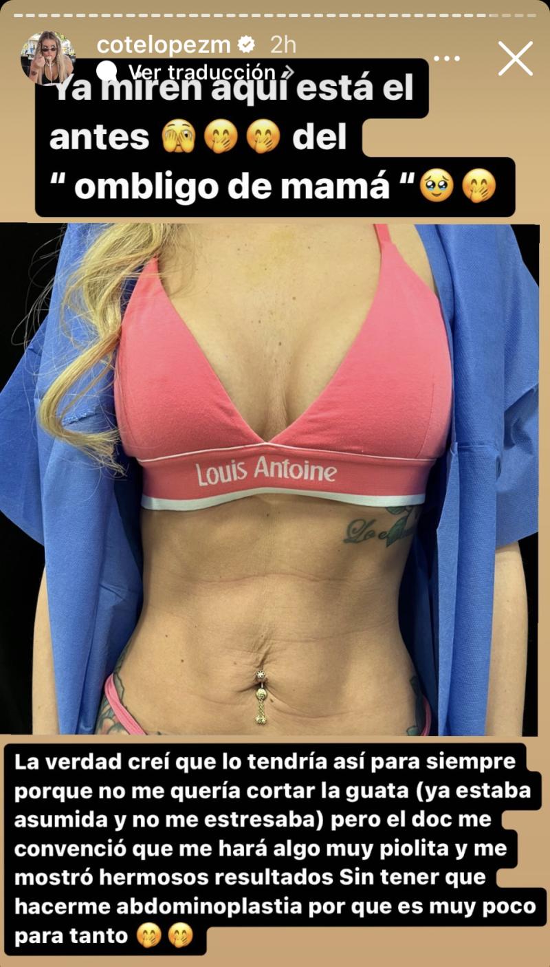 Coté López - Instagram