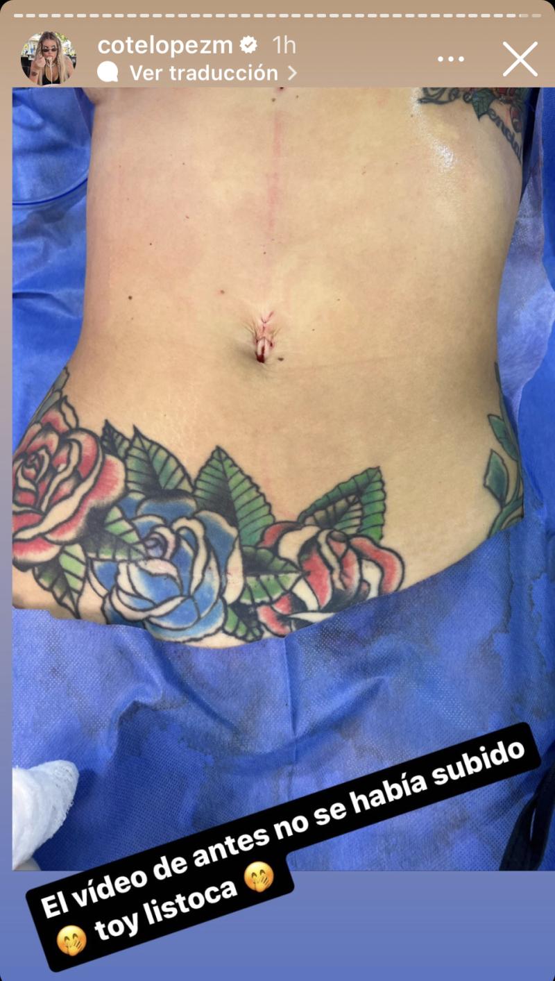 Coté López mostrando los resultados