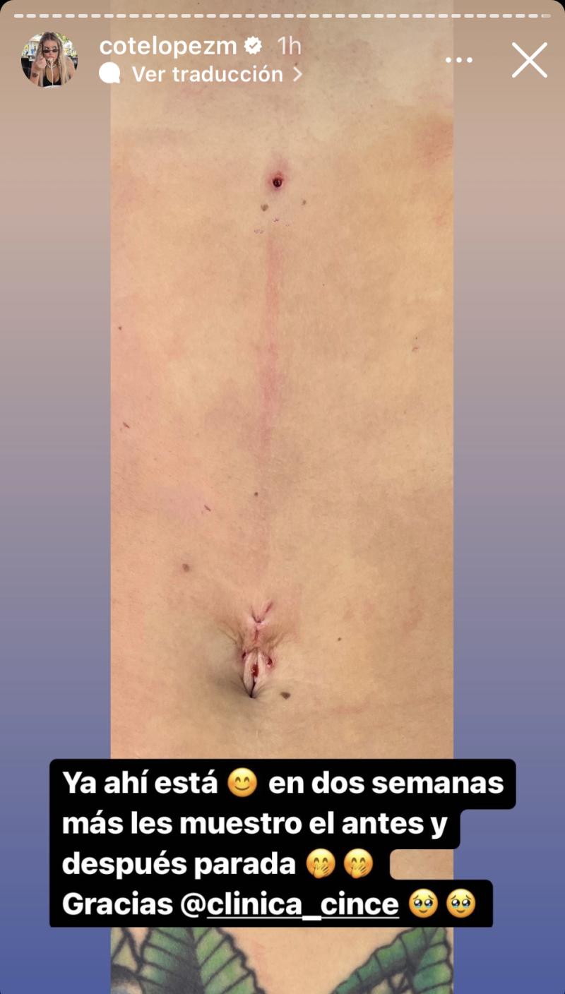 Coté López - Instagram