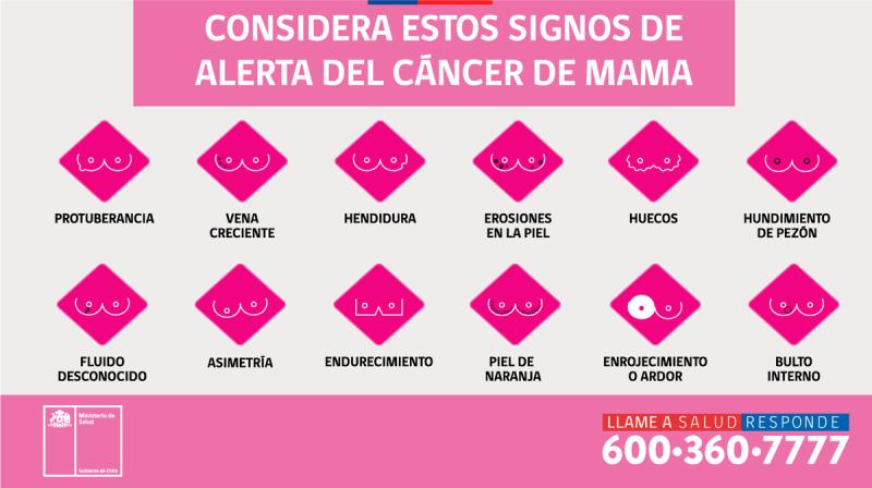 Cáncer de mama