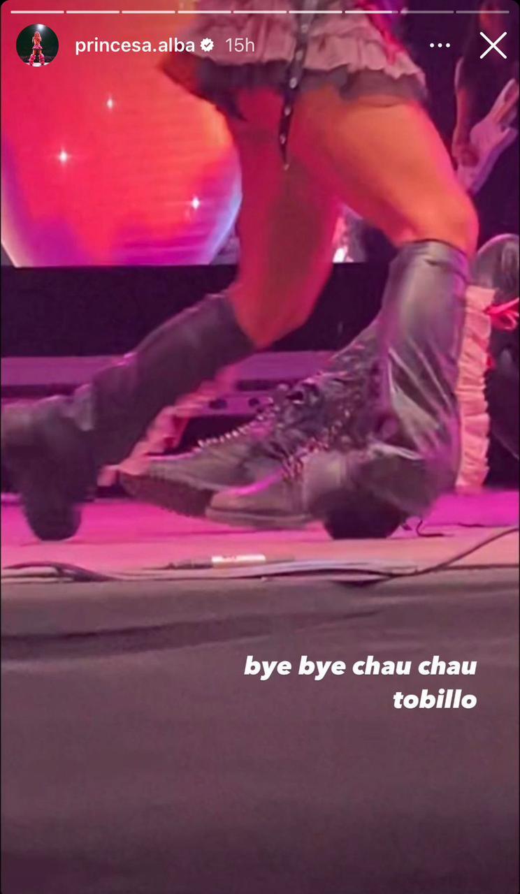 Princesa Alba sufrió doloroso accidente sobre el escenario: mostró cómo quedó su tobillo