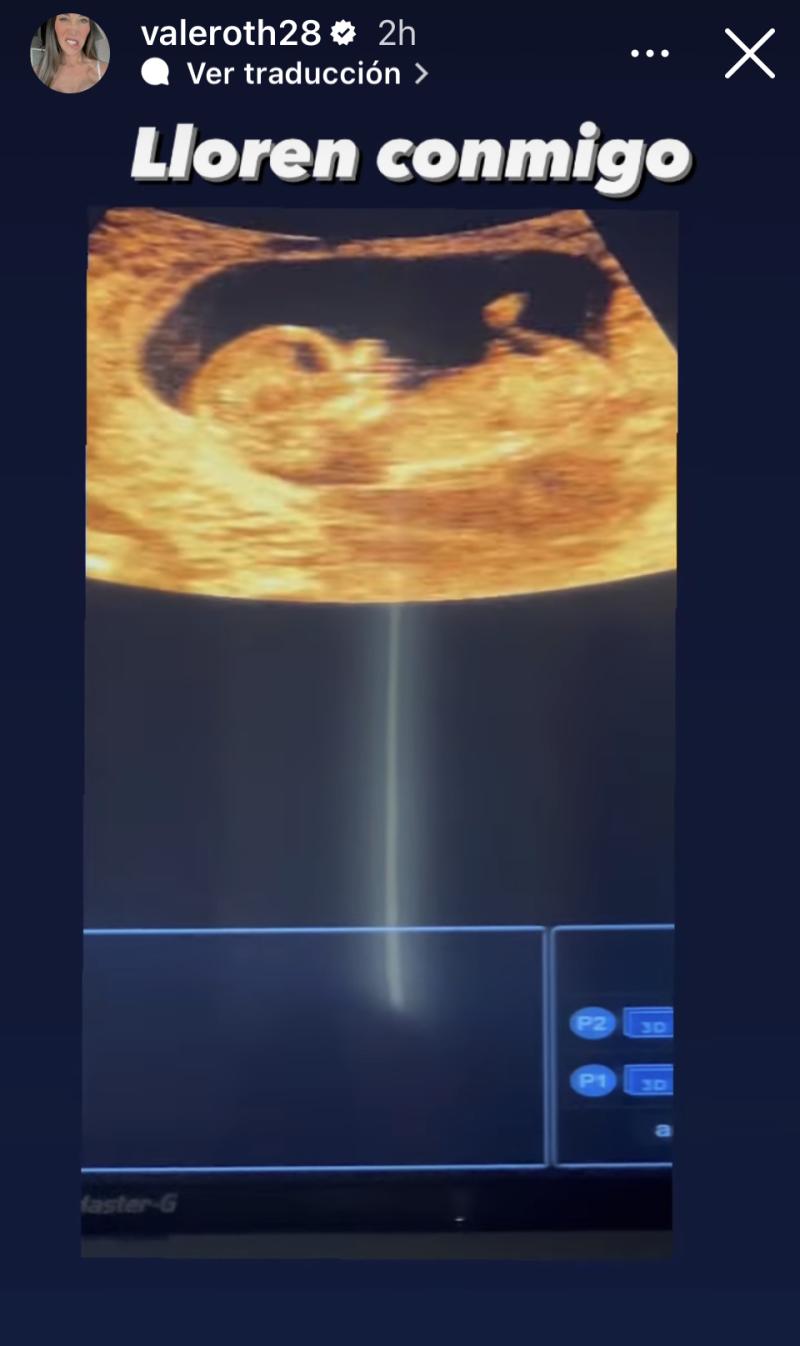 Vale Roth - Instagram