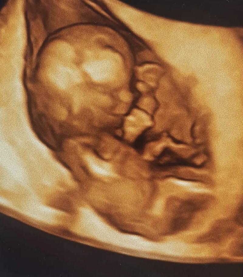 Carla Pinto - Instagram